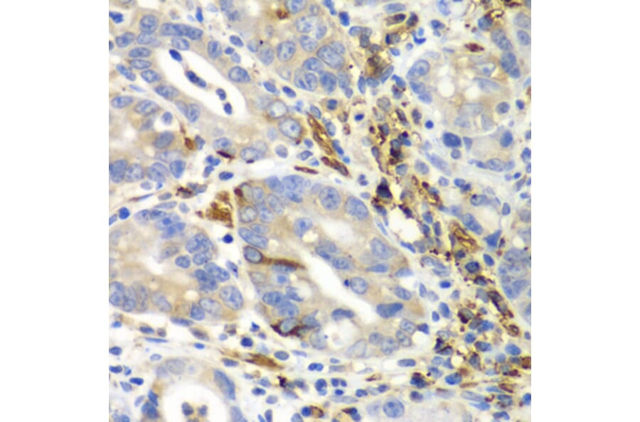 Immunohistochemistry - Anti-EMAP II/AIMP1 Antibody (A14649) - Antibodies.com
