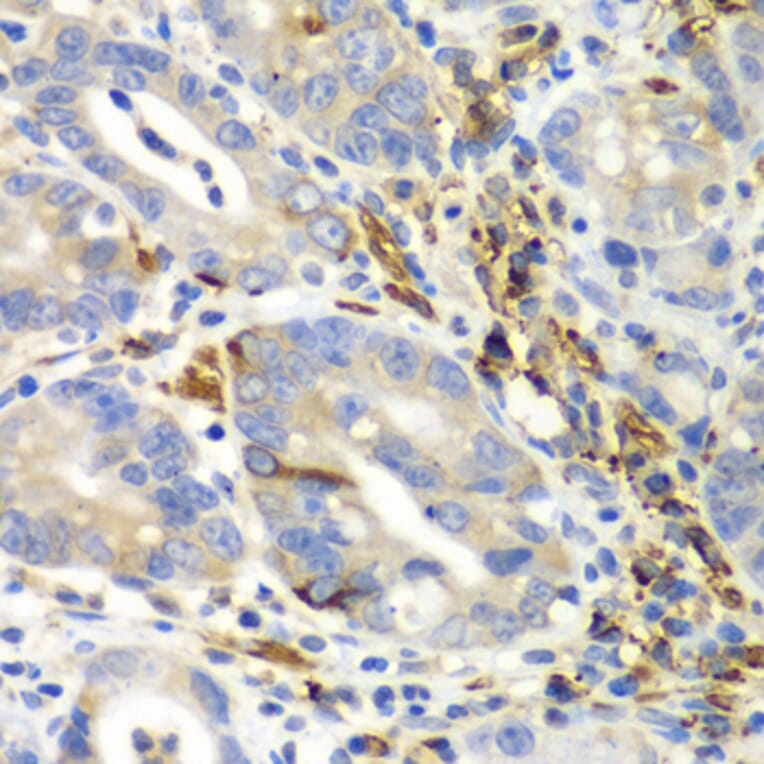 Immunohistochemistry - Anti-EMAP II/AIMP1 Antibody (A14649) - Antibodies.com