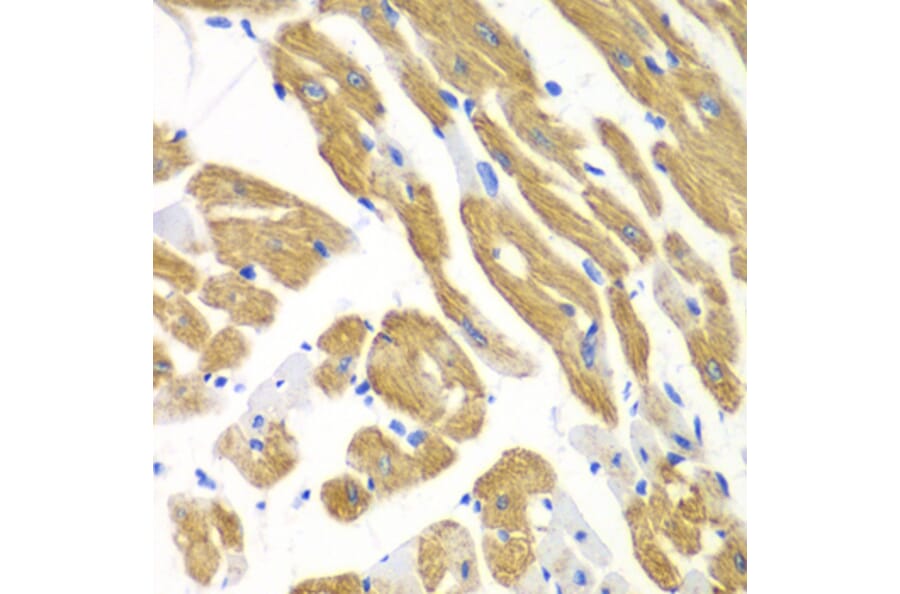Immunohistochemistry - Anti-EMAP II/AIMP1 Antibody (A14649) - Antibodies.com