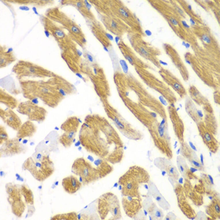 Immunohistochemistry - Anti-EMAP II/AIMP1 Antibody (A14649) - Antibodies.com