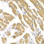 Immunohistochemistry - Anti-EMAP II/AIMP1 Antibody (A14649) - Antibodies.com