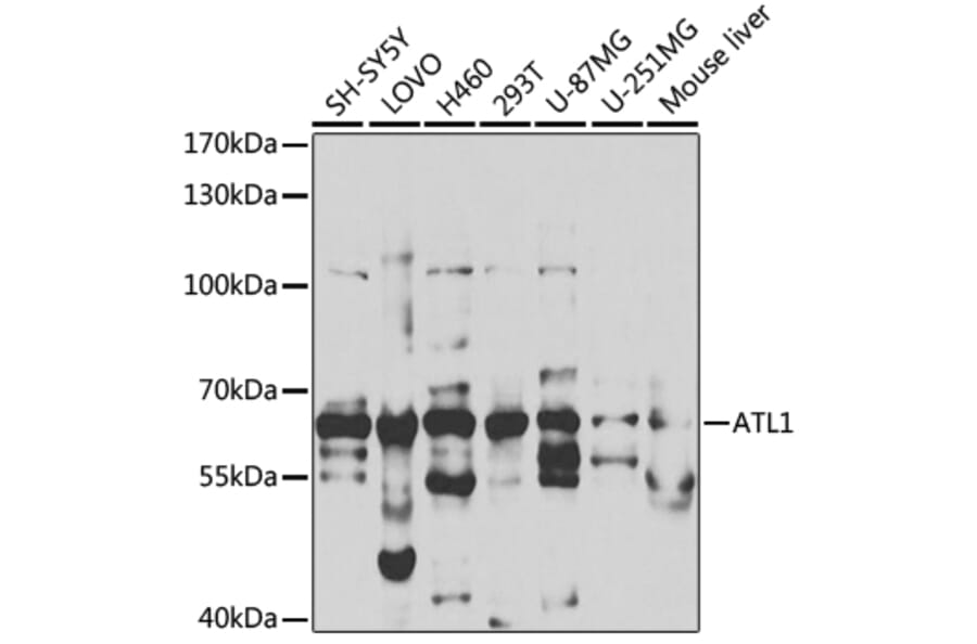 Western Blot - Anti-SPG3A/ATL1 Antibody (A14650) - Antibodies.com