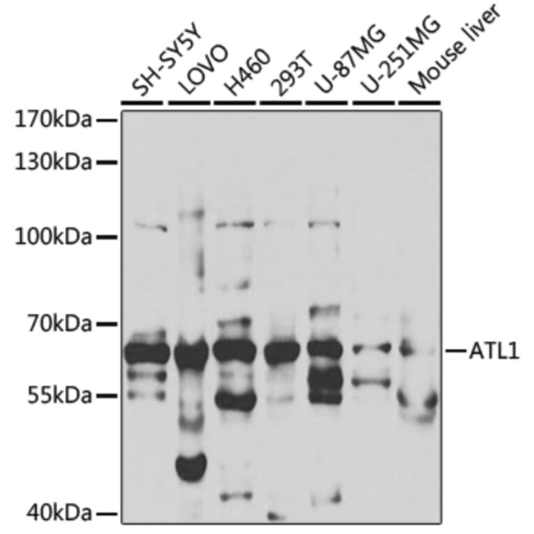 Western Blot - Anti-SPG3A/ATL1 Antibody (A14650) - Antibodies.com