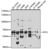 Western Blot - Anti-SPG3A/ATL1 Antibody (A14650) - Antibodies.com