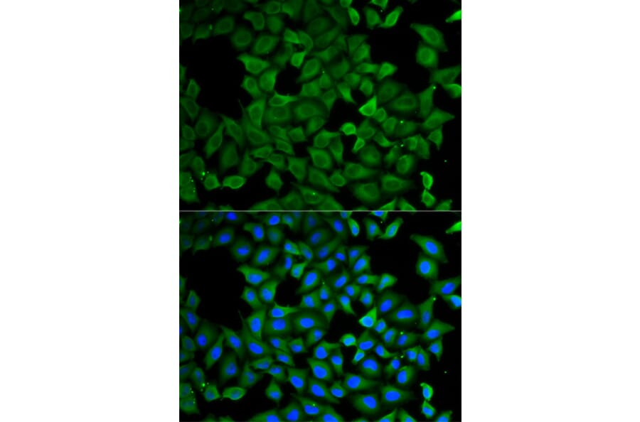 Immunofluorescence - Anti-SPG3A/ATL1 Antibody (A14650) - Antibodies.com