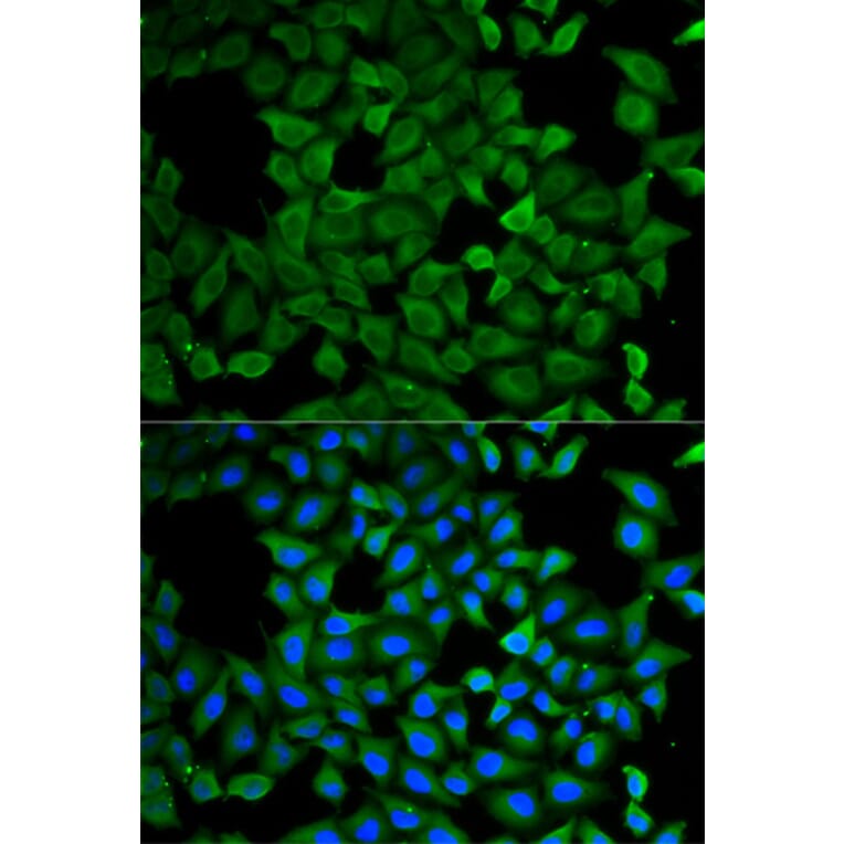 Immunofluorescence - Anti-SPG3A/ATL1 Antibody (A14650) - Antibodies.com