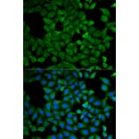 Immunofluorescence - Anti-SPG3A/ATL1 Antibody (A14650) - Antibodies.com