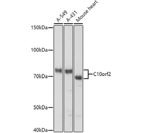 Western Blot - Anti-Twinkle Antibody (A14651) - Antibodies.com