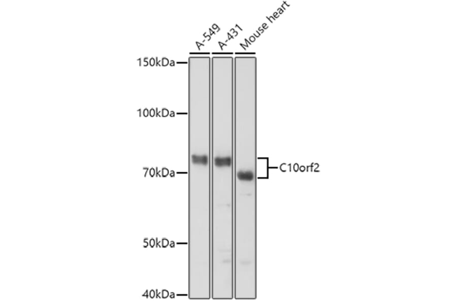 Western Blot - Anti-Twinkle Antibody (A14651) - Antibodies.com