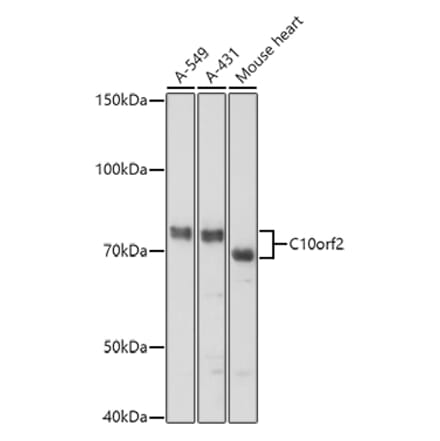 Western Blot - Anti-Twinkle Antibody (A14651) - Antibodies.com