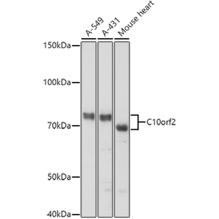 Western Blot - Anti-Twinkle Antibody (A14651) - Antibodies.com