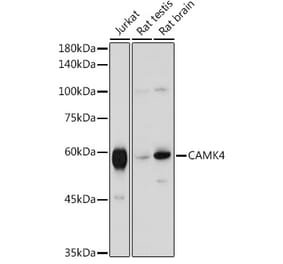 Western Blot - Anti-CAMKIV Antibody (A14652) - Antibodies.com