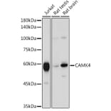 Western Blot - Anti-CAMKIV Antibody (A14652) - Antibodies.com