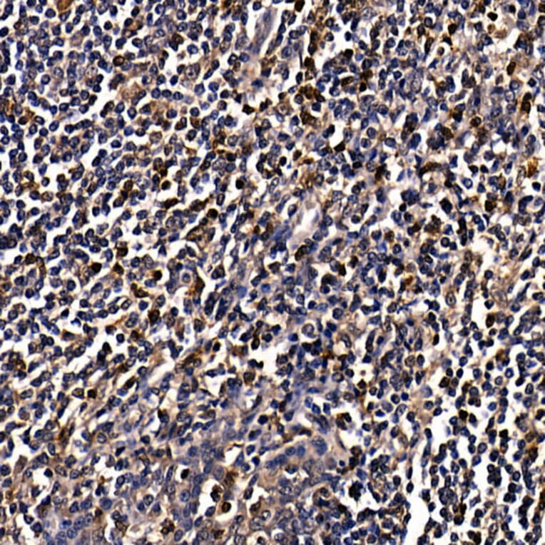 Immunohistochemistry - Anti-CAMKIV Antibody (A14652) - Antibodies.com