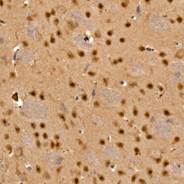 Immunohistochemistry - Anti-CAMKIV Antibody (A14652) - Antibodies.com