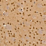 Immunohistochemistry - Anti-CAMKIV Antibody (A14652) - Antibodies.com
