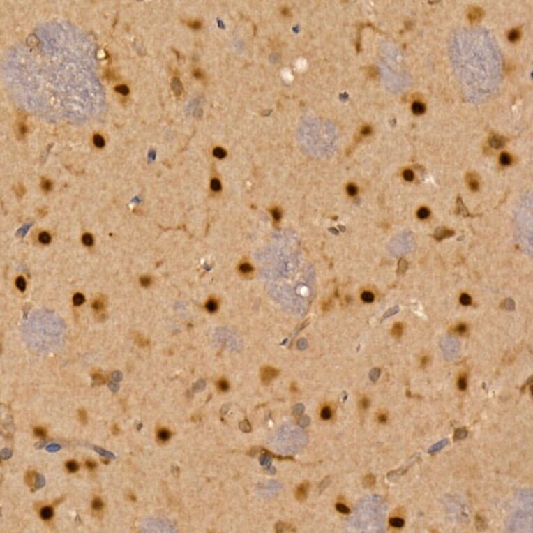 Immunohistochemistry - Anti-CAMKIV Antibody (A14652) - Antibodies.com