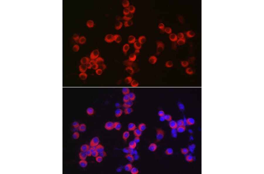 Immunofluorescence - Anti-CAMKIV Antibody (A14652) - Antibodies.com