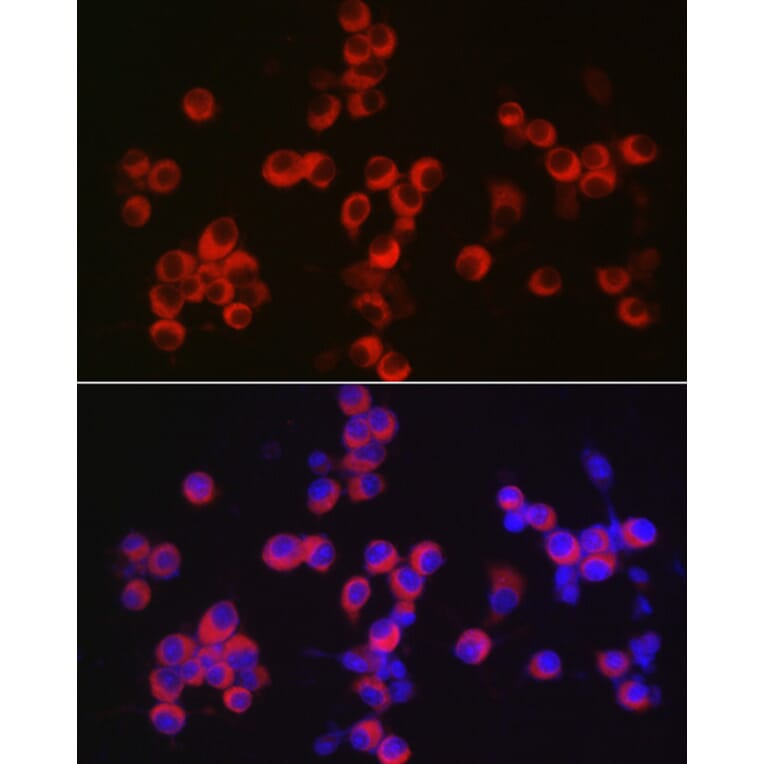 Immunofluorescence - Anti-CAMKIV Antibody (A14652) - Antibodies.com