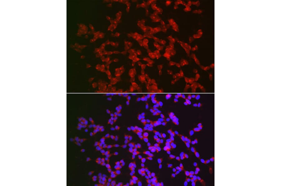 Immunofluorescence - Anti-CAMKIV Antibody (A14652) - Antibodies.com