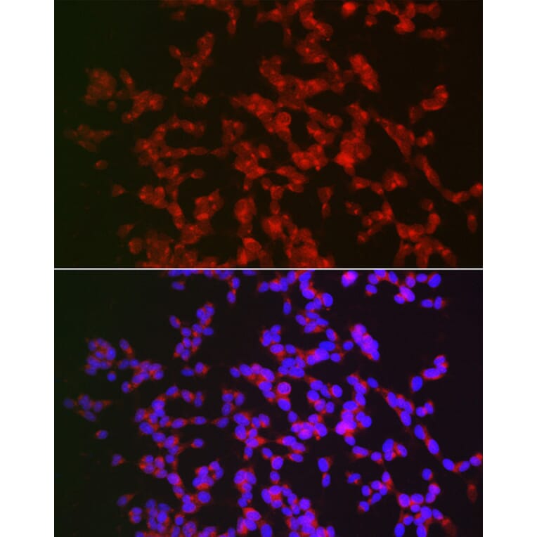 Immunofluorescence - Anti-CAMKIV Antibody (A14652) - Antibodies.com