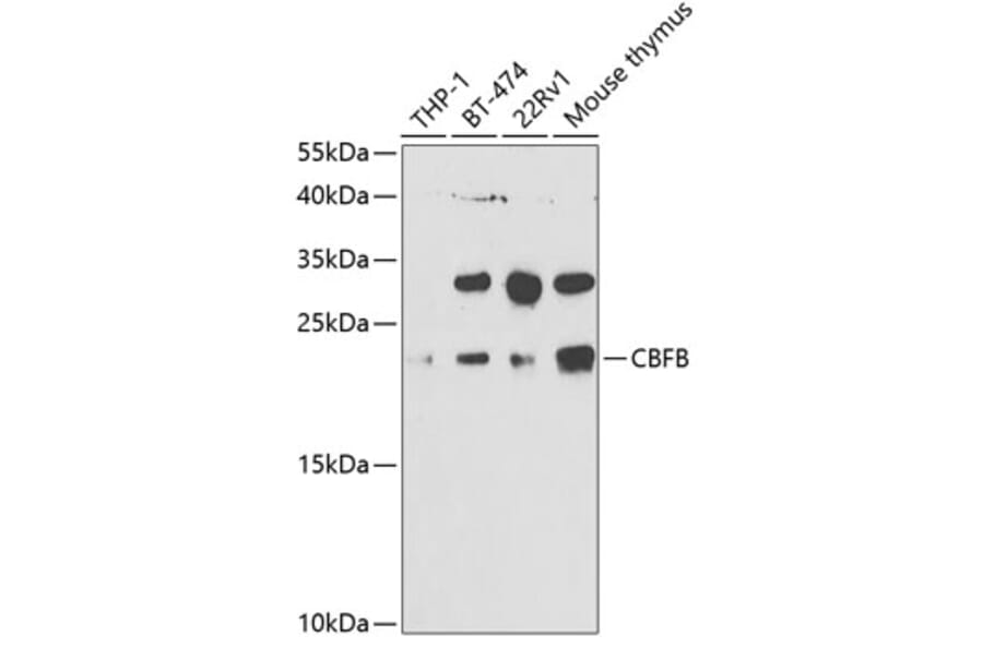 Western Blot - Anti-CBFb Antibody (A14653) - Antibodies.com