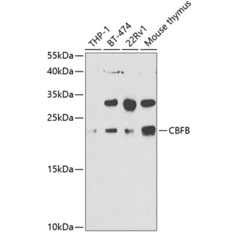 Western Blot - Anti-CBFb Antibody (A14653) - Antibodies.com