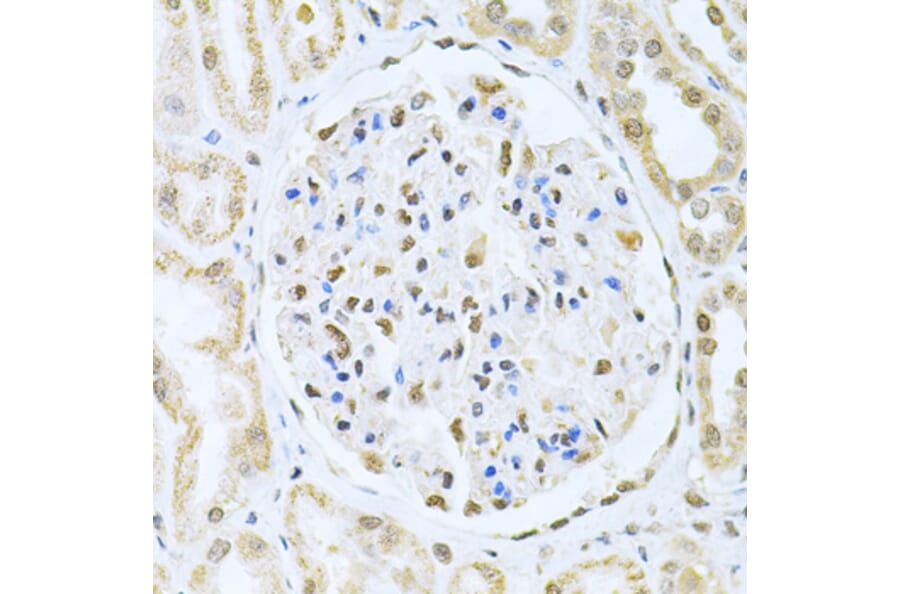 Immunohistochemistry - Anti-CBFb Antibody (A14653) - Antibodies.com