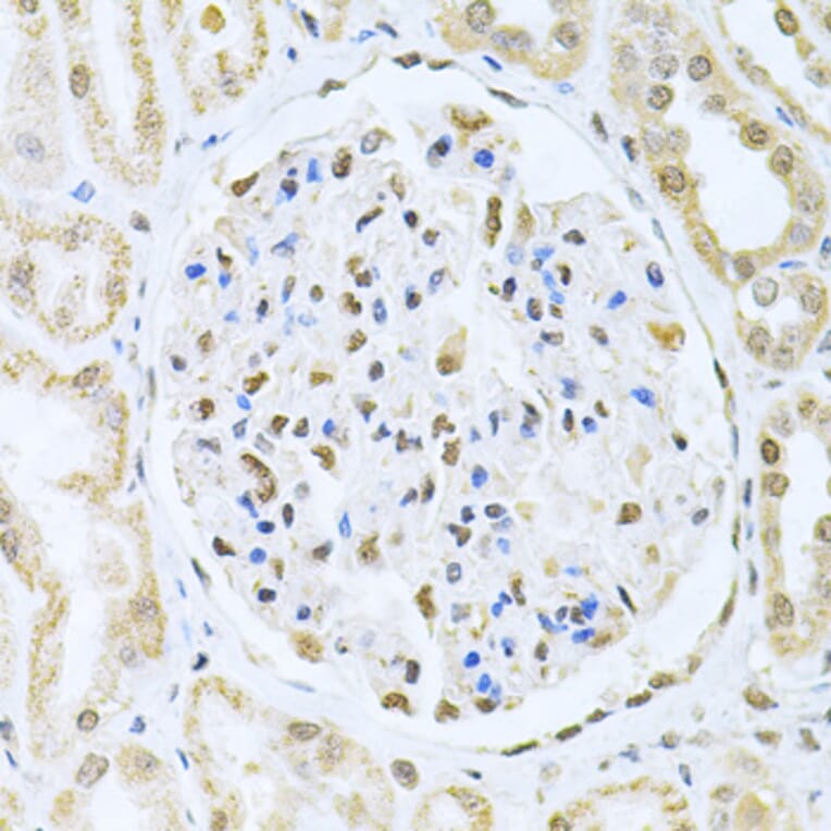 Immunohistochemistry - Anti-CBFb Antibody (A14653) - Antibodies.com