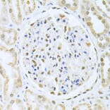 Immunohistochemistry - Anti-CBFb Antibody (A14653) - Antibodies.com