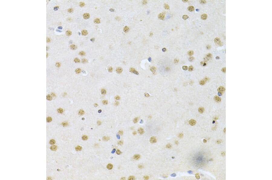 Immunohistochemistry - Anti-CBFb Antibody (A14653) - Antibodies.com