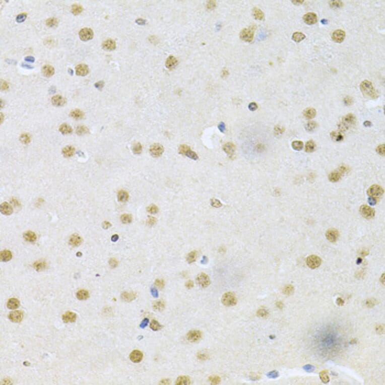Immunohistochemistry - Anti-CBFb Antibody (A14653) - Antibodies.com