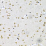 Immunohistochemistry - Anti-CBFb Antibody (A14653) - Antibodies.com