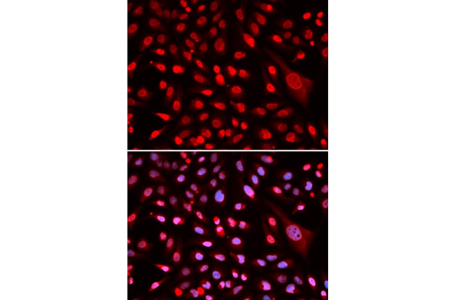 Immunofluorescence - Anti-CBFb Antibody (A14653) - Antibodies.com