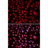 Immunofluorescence - Anti-CBFb Antibody (A14653) - Antibodies.com