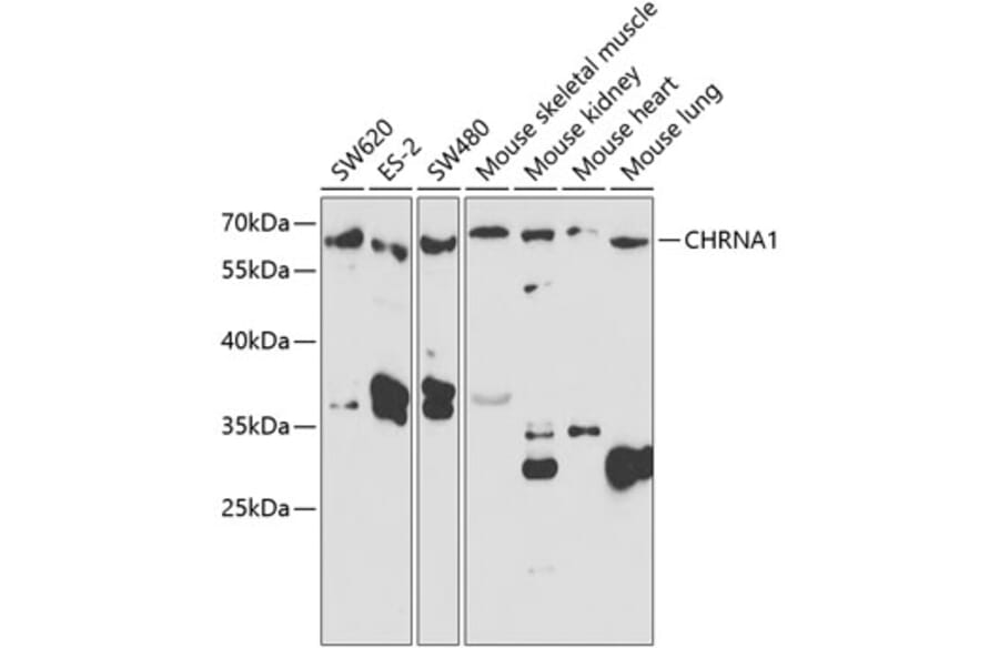 Western Blot - Anti-Nicotinic Acetylcholine Receptor alpha 1/CHRNA1 Antibody (A14654) - Antibodies.com