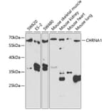 Western Blot - Anti-Nicotinic Acetylcholine Receptor alpha 1/CHRNA1 Antibody (A14654) - Antibodies.com