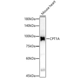 Western Blot - Anti-CPT1A Antibody (A14655) - Antibodies.com