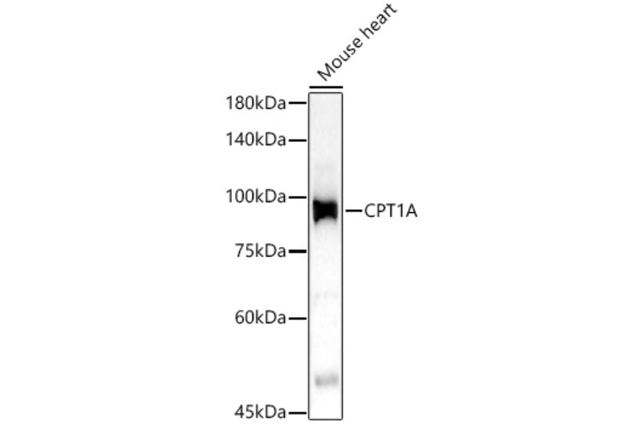 Western Blot - Anti-CPT1A Antibody (A14655) - Antibodies.com