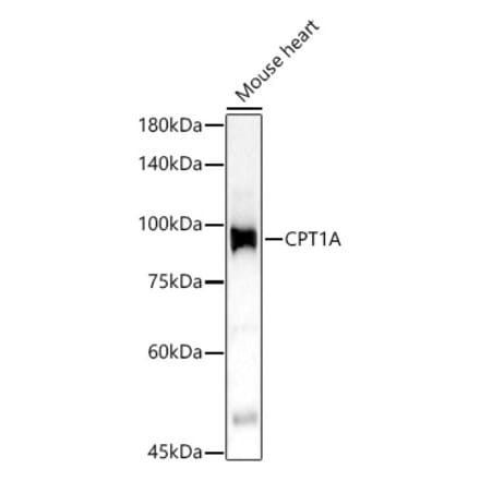 Western Blot - Anti-CPT1A Antibody (A14655) - Antibodies.com