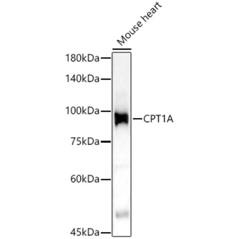 Western Blot - Anti-CPT1A Antibody (A14655) - Antibodies.com