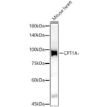 Western Blot - Anti-CPT1A Antibody (A14655) - Antibodies.com