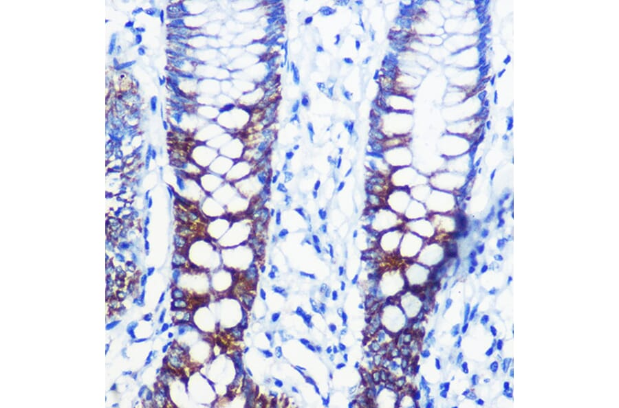 Immunohistochemistry - Anti-CPT1A Antibody (A14655) - Antibodies.com