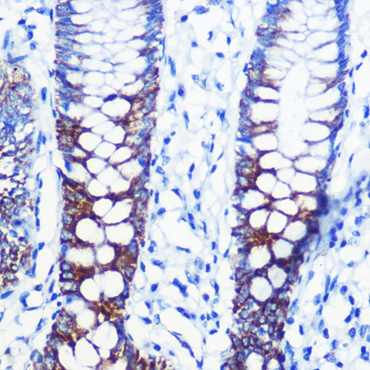 Immunohistochemistry - Anti-CPT1A Antibody (A14655) - Antibodies.com