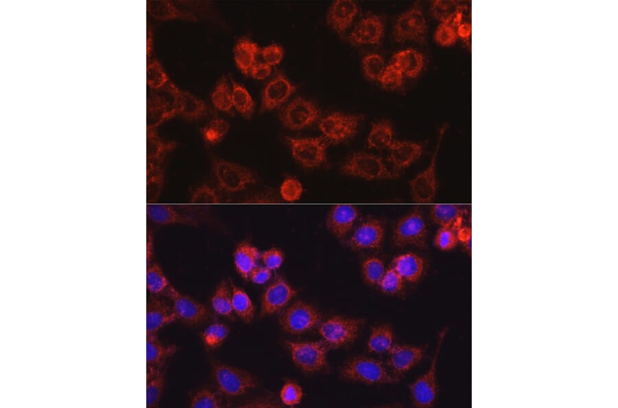Immunofluorescence - Anti-CPT1A Antibody (A14655) - Antibodies.com