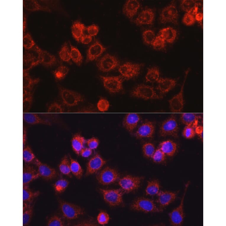 Immunofluorescence - Anti-CPT1A Antibody (A14655) - Antibodies.com