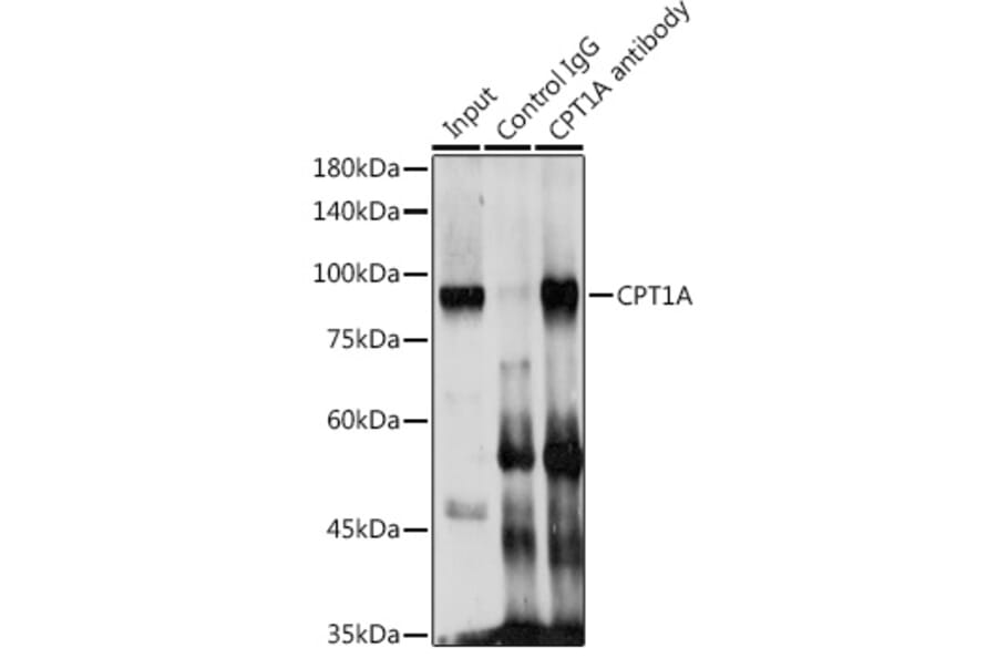 Western Blot - Anti-CPT1A Antibody (A14655) - Antibodies.com