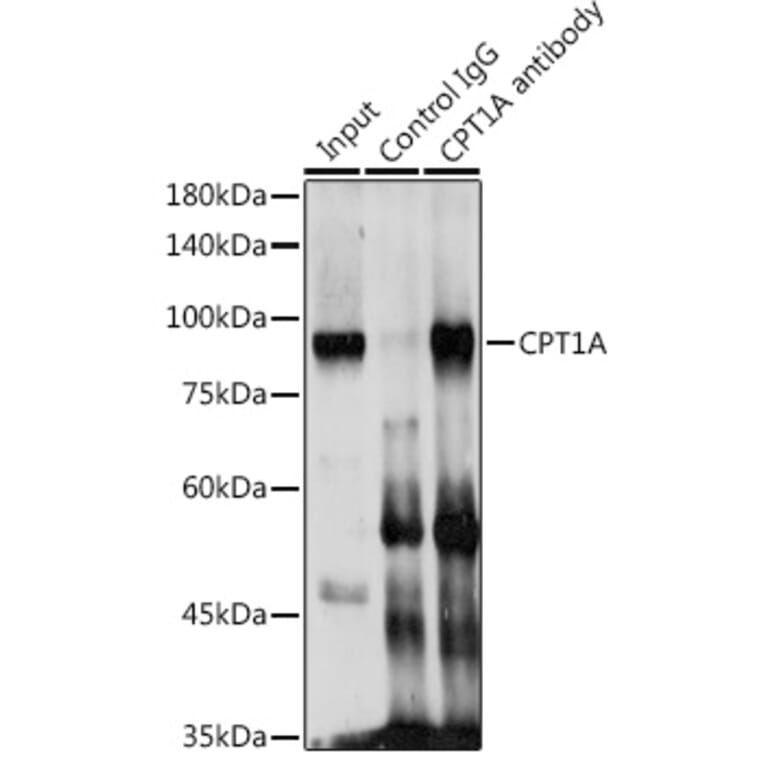 Western Blot - Anti-CPT1A Antibody (A14655) - Antibodies.com