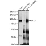 Western Blot - Anti-CPT1A Antibody (A14655) - Antibodies.com