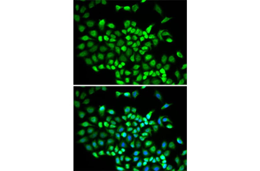 Immunofluorescence - Anti-Cullin 2/CUL-2 Antibody (A14656) - Antibodies.com